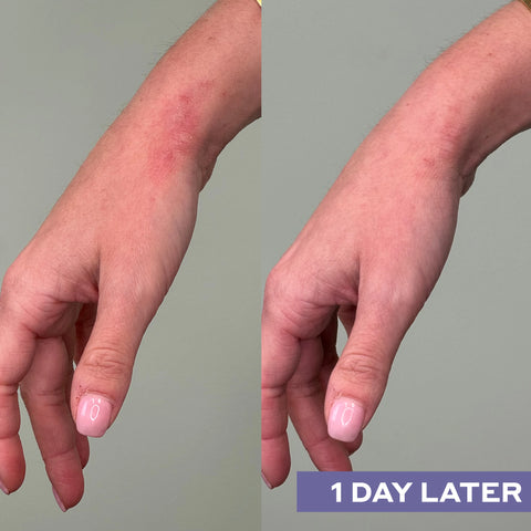 Repairing Facial Spray with Hypochlorous Acid